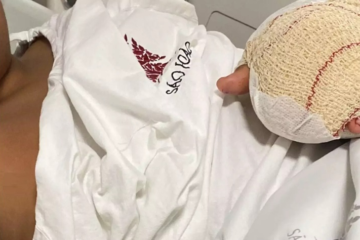 Menino brasileiro tem dedos amputados em escola de Portugal; família aponta racismo