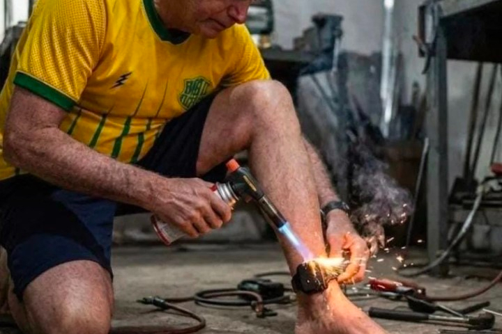 O CASO DA TORNOZELEIRA