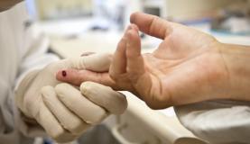 Diagnóstico precoce do vÃrus HIV e o inÃcio do tratamento é considerado o método mais eficaz de prevenir mortes por aids e causas associadas (Foto: Arquivo/Agência Brasil) Diagnóstico precoce do vÃrus HIV e o inÃcio do tratamento é considerado o método mais eficaz de prevenir mortes por aids e causas associadas (Foto: Arquivo/Agência Brasil)