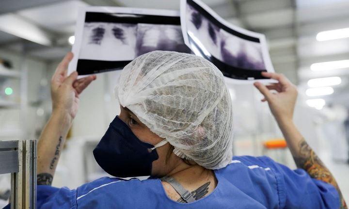 RADIOGRAFIA