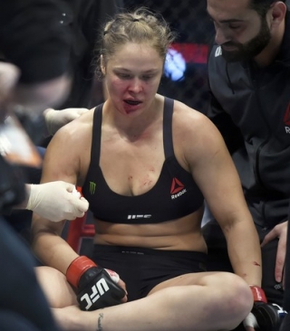 Ronda Rousey após derrota no UFC 193 (Foto: Andy Brownbill / AP) Ronda Rousey após derrota no UFC 193 (Foto: Andy Brownbill / AP)