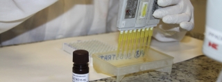 Técnica do exame de diagnóstico do zika vÃrus por biologia molecular, disponibilizado pela Funed para análise das amostras enviadas pelos serviços de saúde de Minas Gerais (Foto: Gleisson Mateus) Técnica do exame de diagnóstico do zika vÃrus por biologia molecular, disponibilizado pela Funed para análise das amostras enviadas pelos serviços de saúde de Minas Gerais (Foto: Gleisson Mateus)